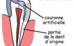 Une dent contre nous?